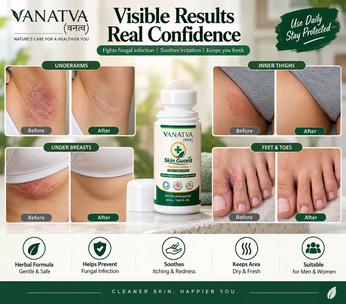 VANATVA Skin Guard Herbal Lotion Roll-On| Ayurvedic | 50 mL